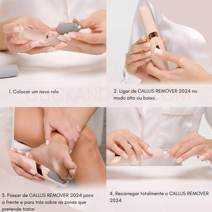 🦶 Removedor de Calos™ – Pés Macios e Suaves